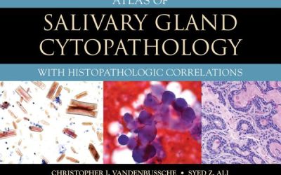 Atlas of Salivary Gland Cytopathology With Histopathologic Correlations First Edition