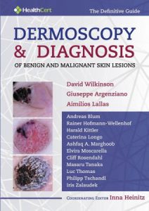 Dermoscopy And Diagnosis Of Benign and Malignant Skin Lesions First Edition