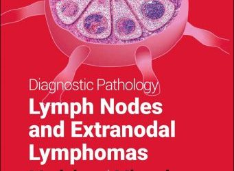 Diagnostic Pathology Lymph Nodes and Extranodal Lymphomas Third Edition