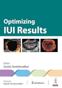 Optimizing IUI Results Second Edition