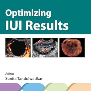 Optimizing IUI Results Second Edition