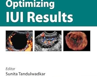 Optimizing IUI Results Second Edition