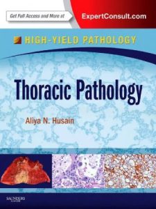 Thoracic Pathology A Volume in the High Yield Pathology Series First Edition