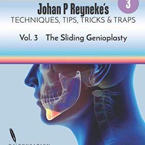 Johan P. Reyneke’s Techniques, Tips, Tricks and Traps Vol 3: The Sliding Genioplasty