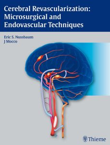 Cerebral Revascularization: Microsurgical and Endovascular Techniques 1st Edition
