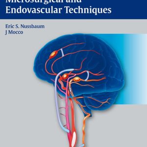 Cerebral Revascularization: Microsurgical and Endovascular Techniques 1st Edition