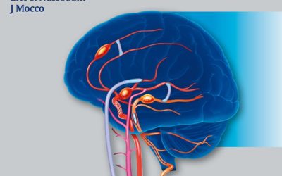 Cerebral Revascularization: Microsurgical and Endovascular Techniques 1st Edition