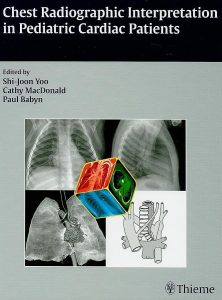 Chest Radiographic Interpretation in Pediatric Cardiac Patients Illustrated Edition