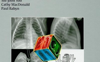 Chest Radiographic Interpretation in Pediatric Cardiac Patients Illustrated Edition