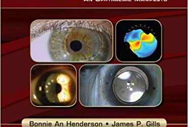 Complete Surgical Guide for Correcting Astigmatism, 2nd Edition