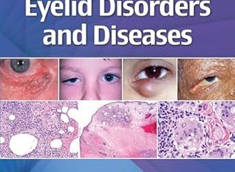 Comprehensive Textbook of Eyelid Disorders and Diseases