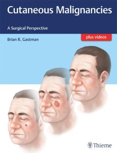 Cutaneous Malignancies – A Surgical Perspective