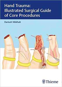 Hand Trauma – Illustrated Surgical Guide of Core Procedure