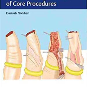 Hand Trauma – Illustrated Surgical Guide of Core Procedure