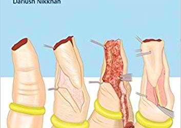 Hand Trauma – Illustrated Surgical Guide of Core Procedure