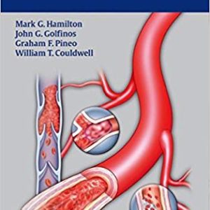 Handbook of Bleeding and Coagulation for Neurosurgery