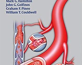 Handbook of Bleeding and Coagulation for Neurosurgery