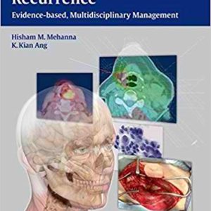 Head and Neck Cancer Recurrence: Evidence-based, Multidisciplinary Management