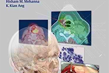 Head and Neck Cancer Recurrence: Evidence-based, Multidisciplinary Management