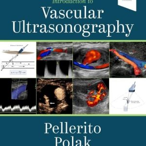 Introduction to Vascular Ultrasonography: Expert Consult 7th Edition