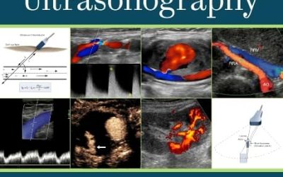 Introduction to Vascular Ultrasonography: Expert Consult 7th Edition