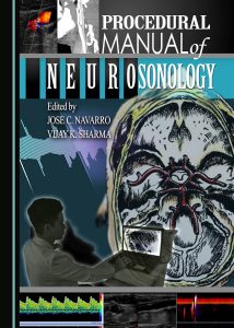Procedural Manual of Neurosonology 1st Edition