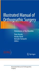 Illustrated Manual of Orthognathic Surgery Osteotomies of the Mandible