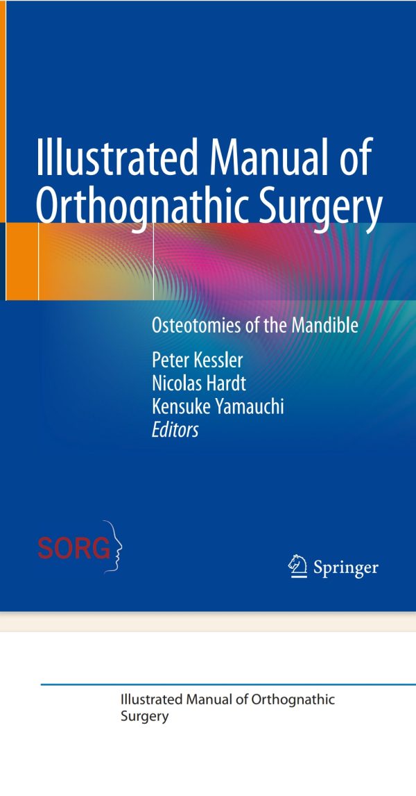 Illustrated Manual of  Orthognathic Surgery Osteotomies of the Mandible