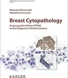 Breast Cytopathology: Assessing the Value of Fnac in the Diagnosis of Breast Lesions (Monographs in Clinical Cytology)