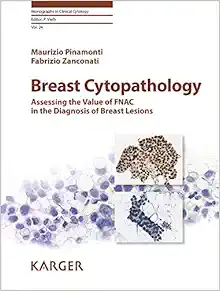 Breast Cytopathology: Assessing the Value of Fnac in the Diagnosis of Breast Lesions (Monographs in Clinical Cytology)