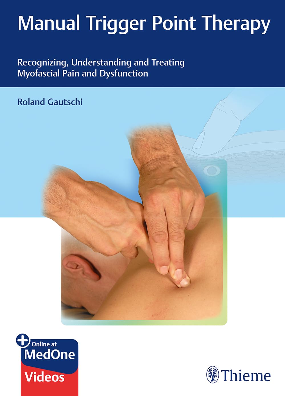 Manual Trigger Point Therapy Recognizing, Understanding, and Treating Myofascial Pain and Dysfunction 1st Edition Manual Trigger Point Therapy: Recognizing, Understanding, and Treating Myofascial Pain and Dysfunction 1st Edition