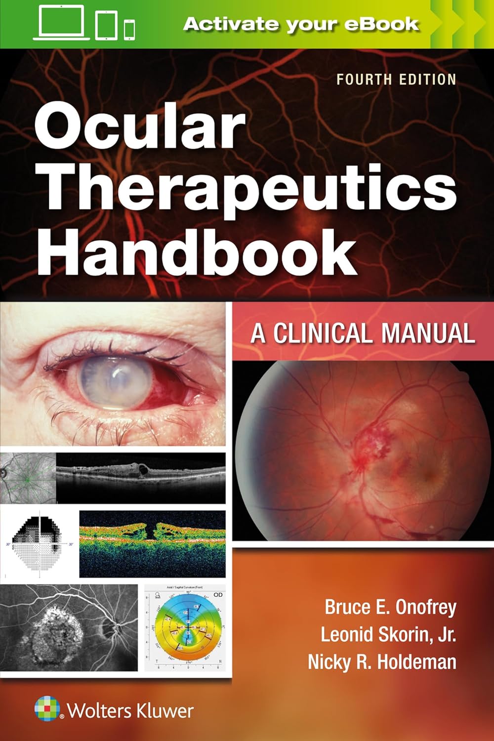 Ocular Therapeutics Handbook A Clinical Manual 4th Edition Ocular Therapeutics Handbook: A Clinical Manual 4th Edition