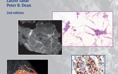 Practical Breast Pathology 2nd Edition