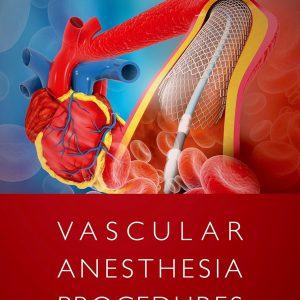 Vascular Anesthesia Procedures