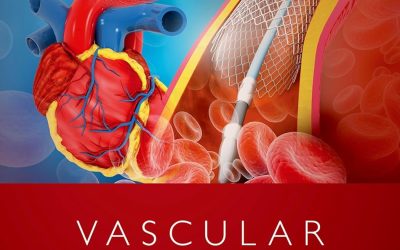 Vascular Anesthesia Procedures