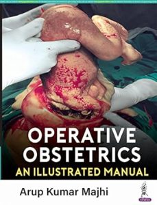 Operative Obstetrics: An Illustrated Manual