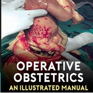 Operative Obstetrics: An Illustrated Manual