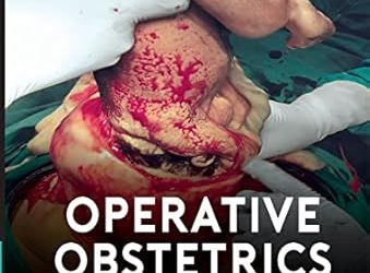 Operative Obstetrics: An Illustrated Manual