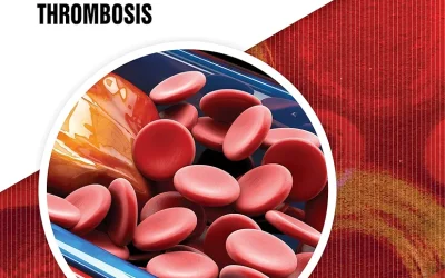 Thrombosis in Cancer: A Medical Professional’s Guide to Cancer Associated Thrombosis