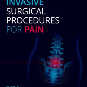 Oxford Minimally Invasive Surgical Procedures For Pain