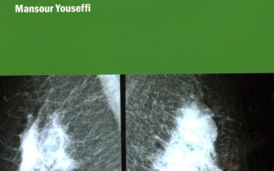 Breast Cancer and Medical Imaging (Iop Series in Medical and Biological Image Analysis)