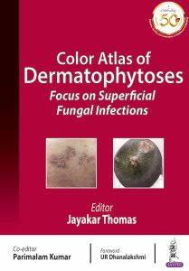 Color Atlas of Dermatophytoses: Focus on Superficial Fungal Infections 1st Edition