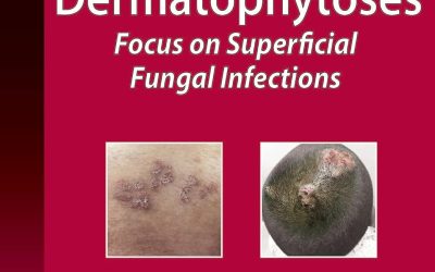 Color Atlas of Dermatophytoses: Focus on Superficial Fungal Infections 1st Edition
