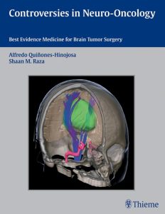 Controversies in Neuro-Oncology: Best Evidence Medicine for Brain Tumor Surgery 1st Edition