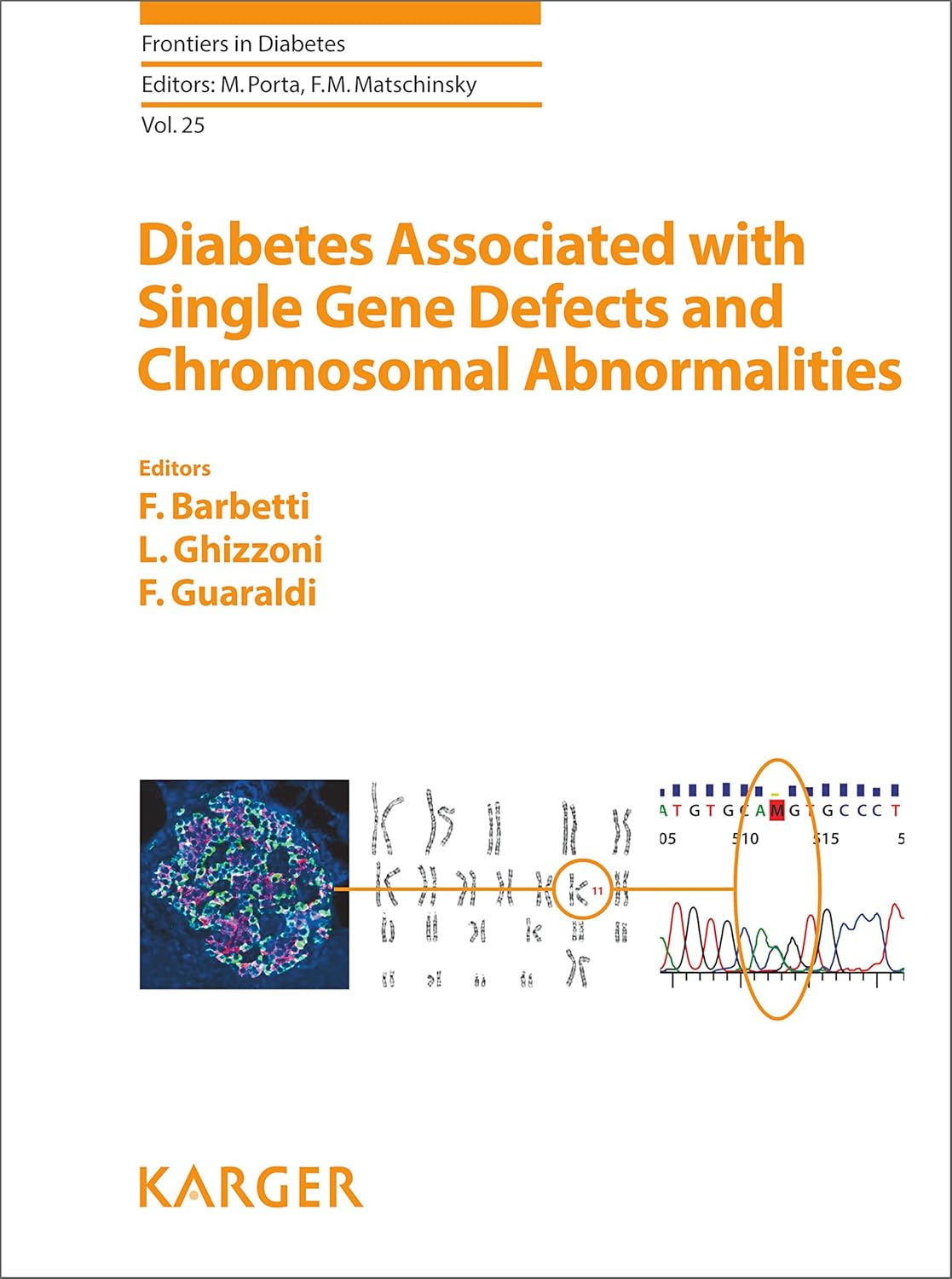 Diabetes Associated with Single Gene Defects and Chromosomal Abnormalities Diabetes Associated with Single Gene Defects and Chromosomal Abnormalities (ISSN Book 25) 1st Edition