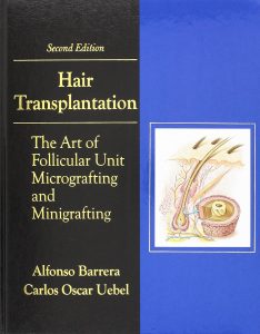 Hair Transplantation: The Art of Micrografting and Minigrafting 2nd Edition
