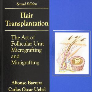 Hair Transplantation: The Art of Micrografting and Minigrafting 2nd Edition