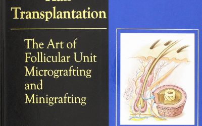 Hair Transplantation: The Art of Micrografting and Minigrafting 2nd Edition
