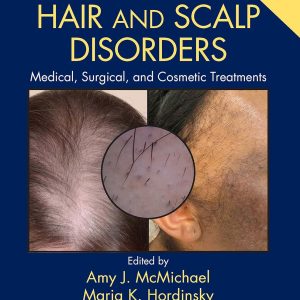 Hair and Scalp Disorders: Medical, Surgical, and Cosmetic Treatments 2E
