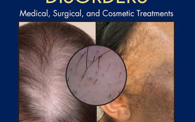 Hair and Scalp Disorders: Medical, Surgical, and Cosmetic Treatments 2E